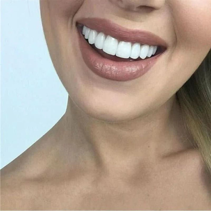 Innowacyjne Licówki Dentystyczne SnapFit – Idealny Uśmiech Bez Wizyt u Dentysty 2