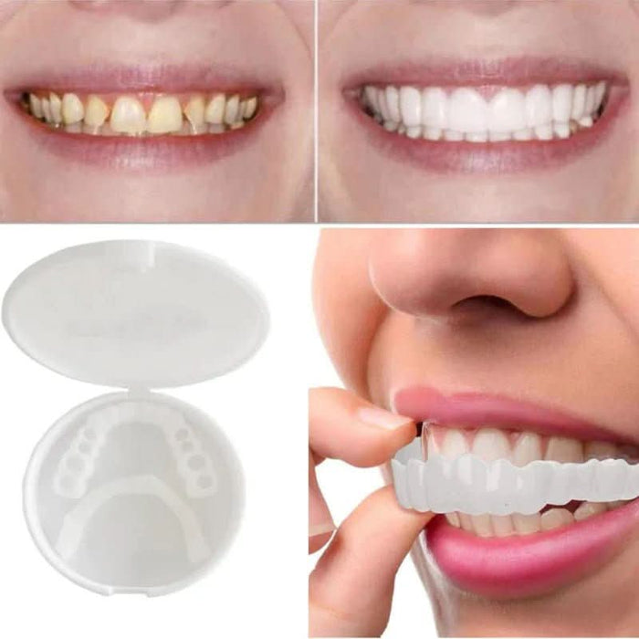 Innowacyjne Licówki Dentystyczne SnapFit – Idealny Uśmiech Bez Wizyt u Dentysty 3